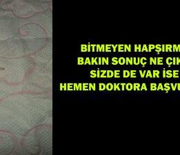 Bitmeyen Hapşırma Bakın Nedenmiş